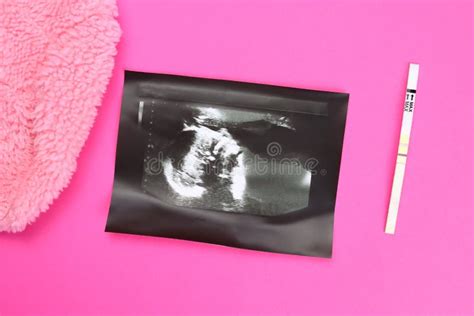 Positive Pregnancy Test An Ultrasound Scan And Baby Clothes The