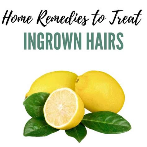 24 Home Remedies To Treat And Prevent Ingrown Hairs Treat Ingrown