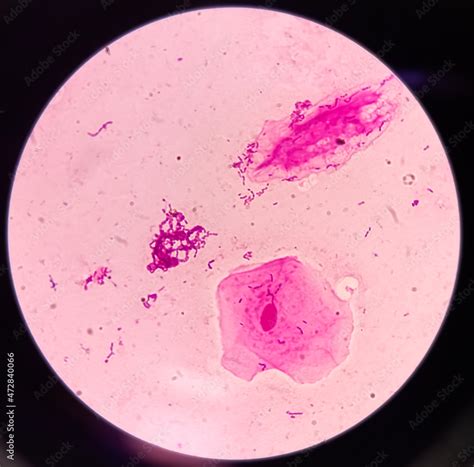 Gram Stain Microscopic Slide Plenty Epithelial Cells Few Pus Cells