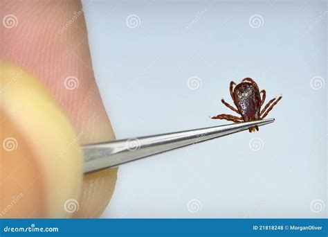 Dog Tick Removal Royalty Free Stock Photos Image 21818248