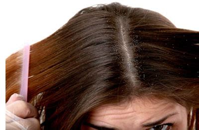Scratching your head can make the condition worse. Reasons for itchy scalp and hair loss