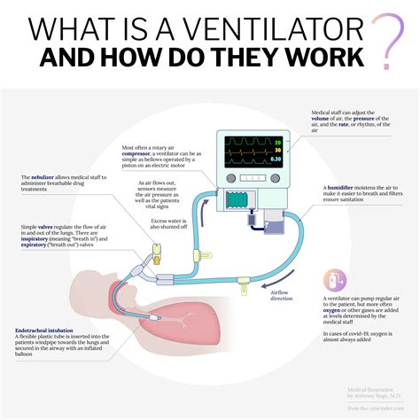 What Is A Ventilator And How Do They Work Ventilator Diagram