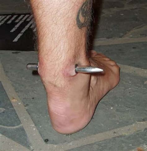 16 Extreme Body Modifications You Have To See To Believe