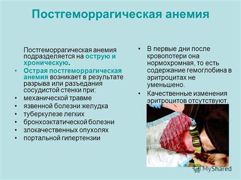 Анемия постгеморрагическая диета Презентация на тему: "АНЕМИИ. ЛЕЙКОЗЫ Кандидат медицинских наук, доцент Презентация на тему: "АНЕМИИ. ЛЕЙКОЗЫ Кандидат медицинских наук, доцент Анемия постгеморрагическая диета
