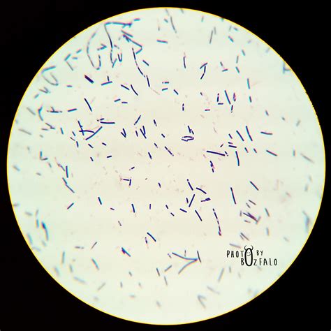 Bacillus Spp Gram Positive Bacilli With Endospore Gram