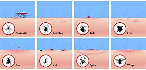 Identifying Common Insect Bites And Stings Sentinel B