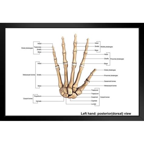Human Left Hand Posterior Dorsal View Bones Anatomy Chart Medical