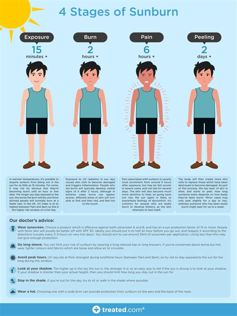 Infographic The 4 Stages Of Sunburn Sunburn Get Rid Of Sunburn