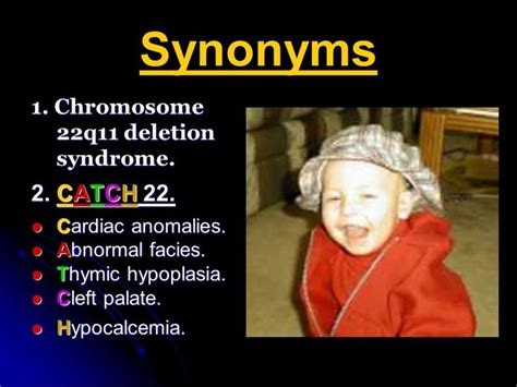 Pin By Nonas Arc On Digeorge Syndrome Digeorge Syndrome Medical