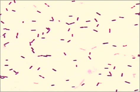 Listeria monocytogenes or just l. Coloración de Gram de cultivo de líquido cefalorraquídeo ...