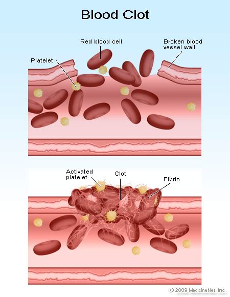 Immunology Immune System Immunity Blood Clotting Mechanism