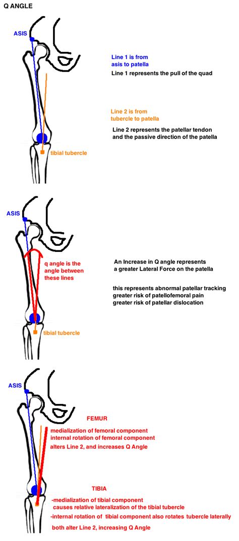 Patellar Tracking — Hip And Knee Book