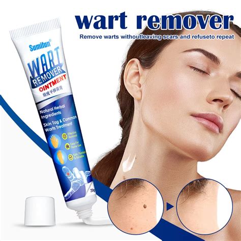 warts remover antibacterial ointment wart treatment cream skin tag remover herbal extract corn
