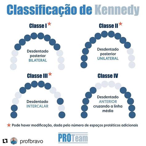 Classificação De Kennedy E Suas Modificações Pdf