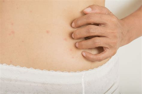 Allergic Reactions During Sexual Intercourse