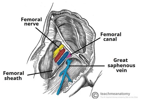 Femoral Canal Hernia