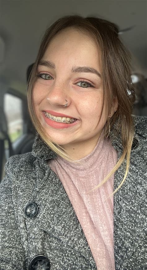 Tw Pornstars Luna Bright🎈 Twitter Wear Your Retainer People You Could End Up With Braces 6