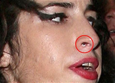 Amy winehouse charity sets up home for female recovering addicts. Amy Winehouse Snapped Again With White-Ringed Nose