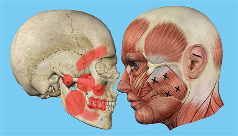 Jaw Pain Or Tmj