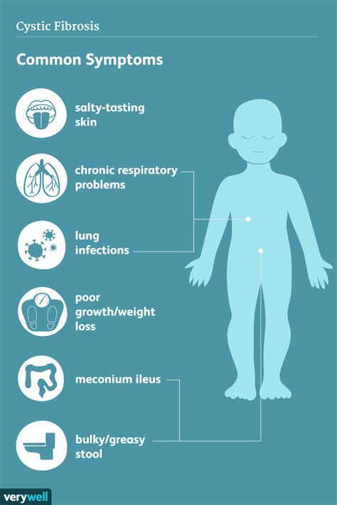 What Is Cystic Fibrosis Infographic Vrogue Co