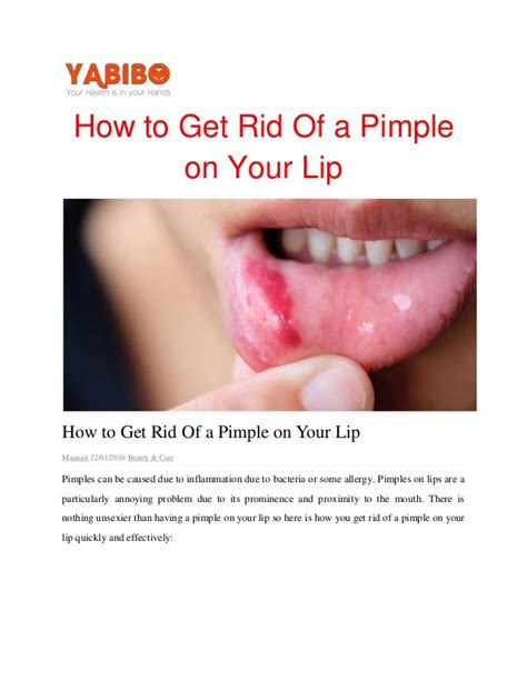 How To Get Rid Of A Pimple On Your Lip