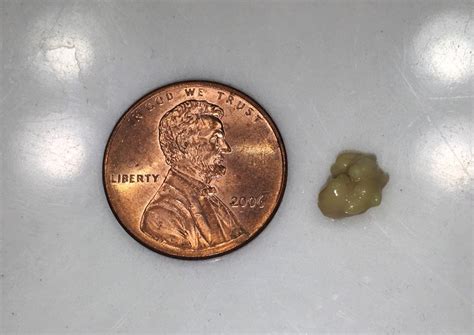 I Popped Out An Unbelievably Sized Tonsil Stone Out This Morning R