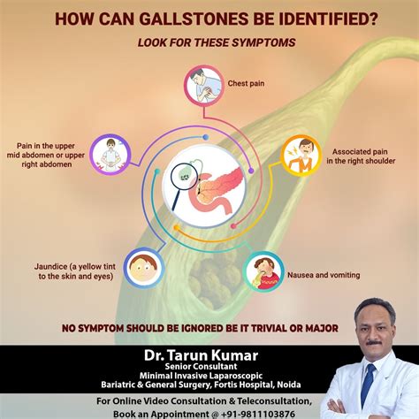 Dr Tarun Kumar The Symptoms Of Gallstones Can Be