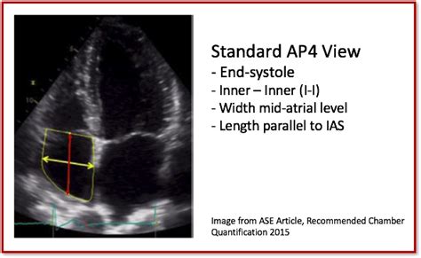 10 Tips For Correct Ra Size Quantification Cardioserv