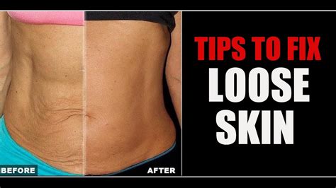 How To Tighten Up Loose Skin Sagging Skin Belly And Arm Skin Info By