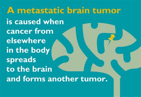 If you have a family history of brain tumors or your brain has been exposed to radiation, say, during radiotherapy, you might be at higher risk. Metastatic Brain Tumor: 6 Things You Need to Know