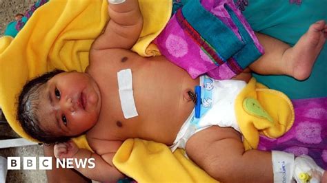 Mum Gives Birth To Heaviest Baby In India Weighing Lb Bbc News