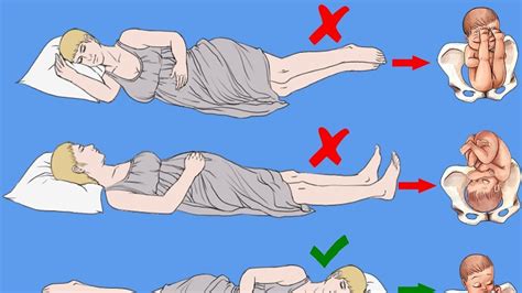 وضعيات نوم خاطئة للحامل تضر بالجنين ما هي وضعية النوم الصحيحة للحامل
