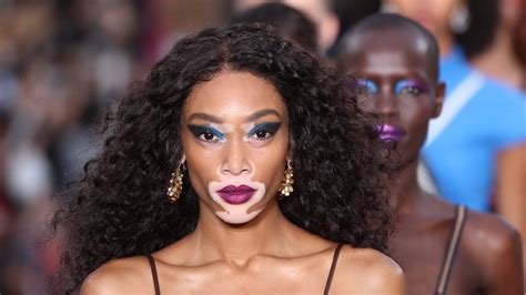 Winnie Harlow Will Reportedly Walk In The 2018 Victorias