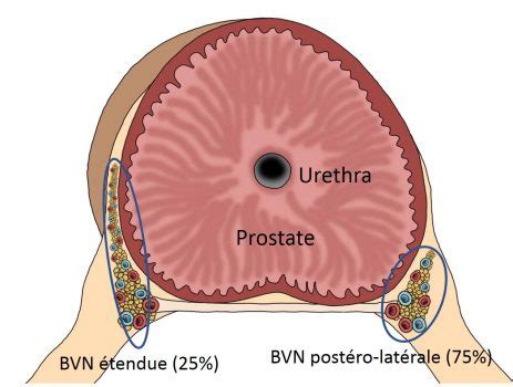 Anatomie De La Prostate Et Effets Secondaires Des Traitements Radicaux