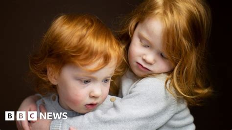 In Pictures Connecting The Worlds Redheads Bbc News