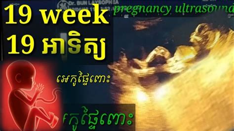 អេកូផ្ទៃពោះ 19 អាទិត្យ Pregnancy Ultrasound 19 Week By Drbun Laysophea