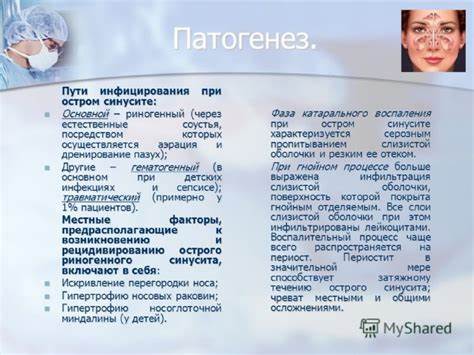 Диета При Синусите У Взрослых — Похудение Диета Правильное Питание Картинка - Диета При Синусите У Взрослых — Похудение Диета Правильное Питание