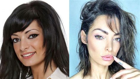 12 candidates de télé réalité avant et après la chirurgie esthétique automasites