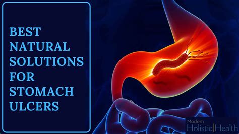 Stomach Ulcer Types