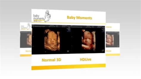 4d Baby Scan Berkshire Call 08000075076 Uk Coub