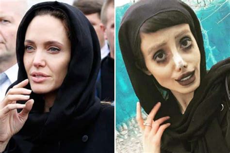 Iranian Teen Who Underwent 50 Surgeries To Look Like Angelina Jolie