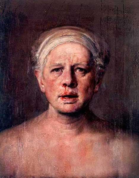 Self Portrait With Nose Bleed Odd Nerdrum