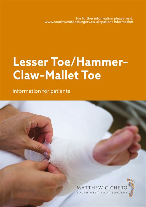 Lesser Toe Hammer Claw Mallet Toe — South West Foot Surgery