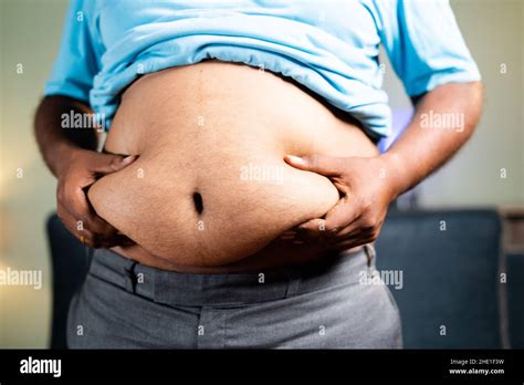 Unrecognizable Fat Man Checking By Shaking Belly Fat Concept Of