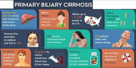 Primary Biliary Cirrhosis New