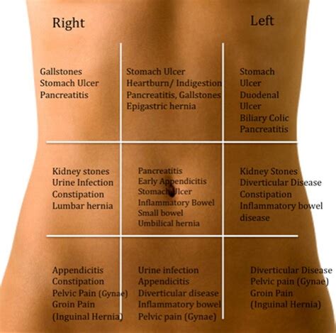 Abdomen Pain Chart