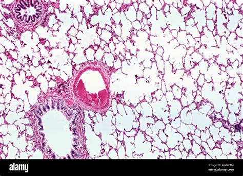 Anatomía E Histología Pulmonar Humana Fotografías E Imágenes De Alta