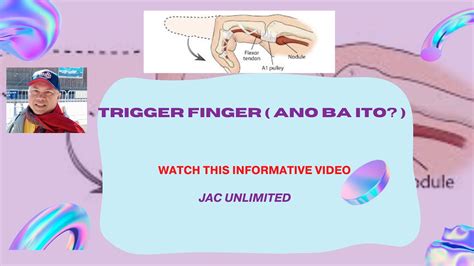 Trigger Finger Ano Ba Ito Youtube