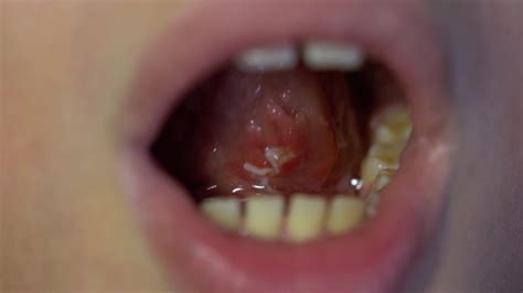 Frenulum Footage Videos And Clips In Hd And K Avopix Com