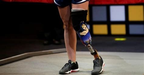 Prostheticsamputees Can Now Feel Their Feet Just Like A Real Leg